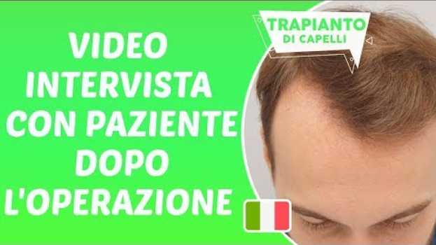 Video Trapianto Capelli in Turchia - Video Intervista con Paziente dopo l'Operazione - Dr. Hamid AYDIN in English