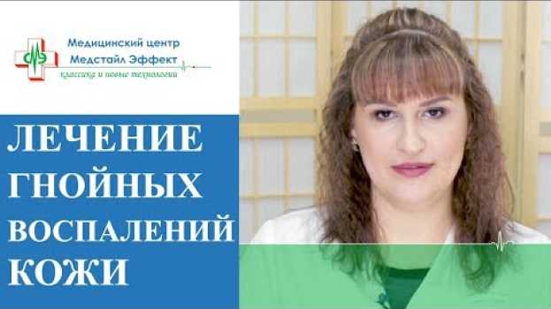 Video 🔴 Случаи подкожных воспалений, когда необходимо обратиться к хирургу. Подкожные воспаления. 12+ en français