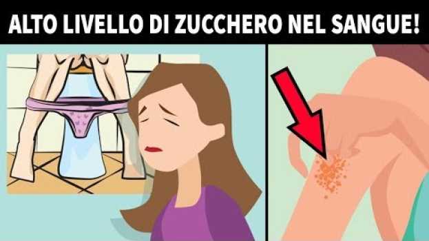 Video I 12 Segnali Che Dimostrano Che I Livelli Di Zucchero Nel Tuo Sangue Sono Molto Alti   türkçe